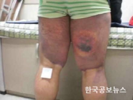기사 사진